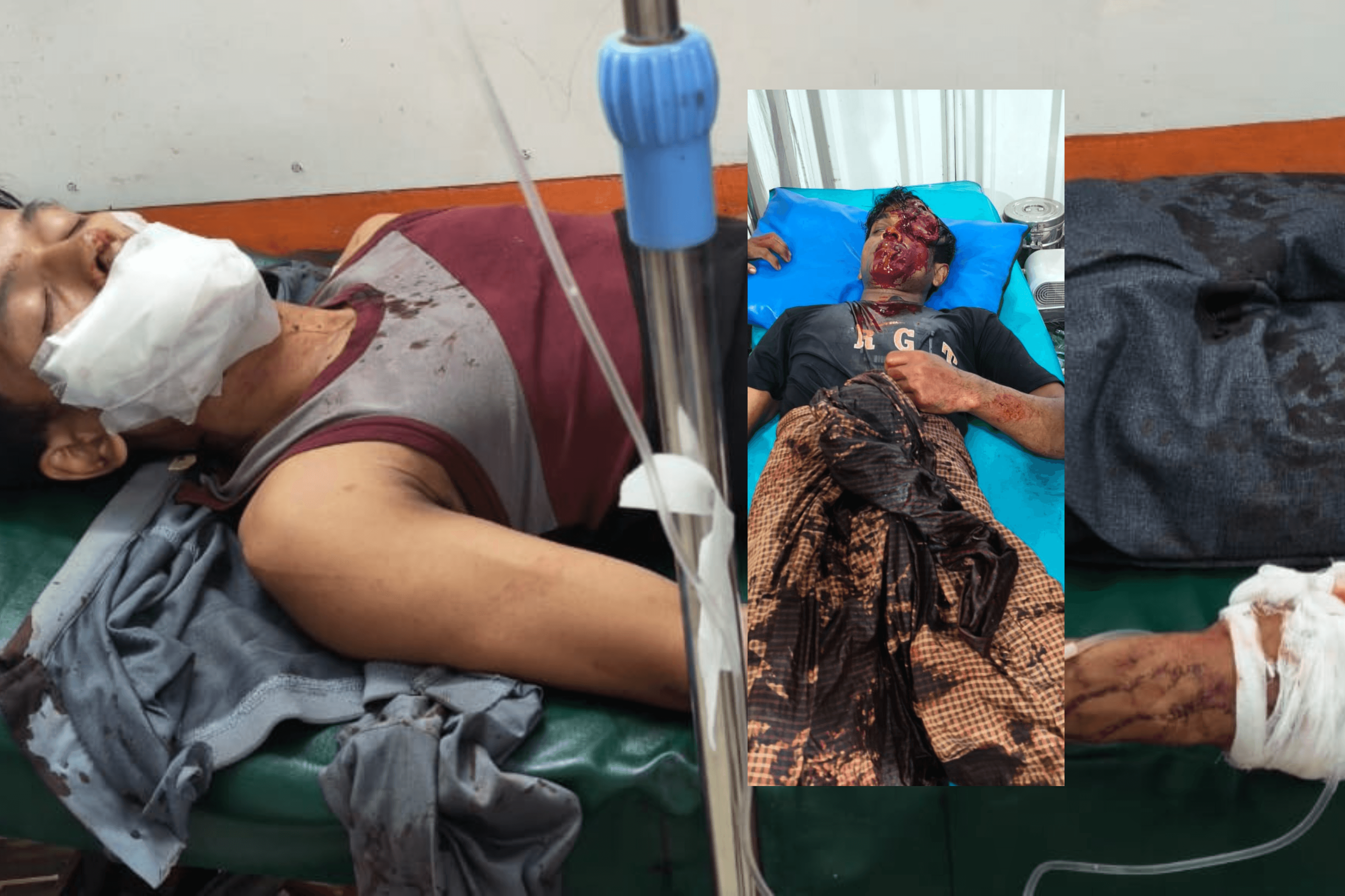 Two Rohingya Stabbed by Four Christians at Camp-13 in Cox’s Bazar